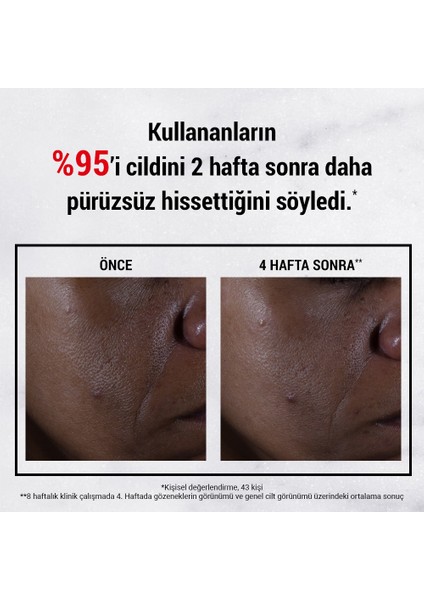 Ultra Pure %9.8 Glikolik Asit Pürüzsüzlük Etkili Yüz Serumu 30ml