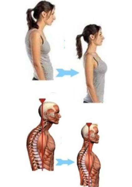 Dik Durma Aparatı - Sensorlü - Sırt Düzeltme Bandajı - Titreşimli Dik Duruş Korsesi modelleri
