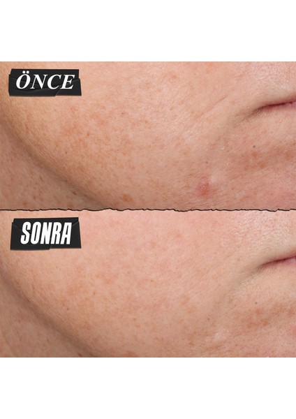 Dermatologist Solutions Retinol Içeren Günlük Serum 50 Ml