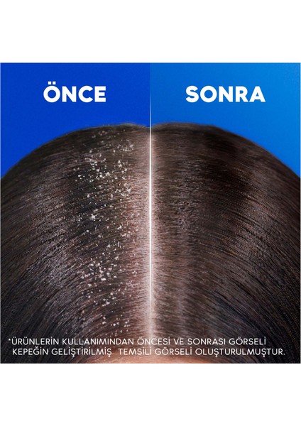 Head & Shoulders Şampuan Limon Ferahlığı 2in1 330 Ml X3adet