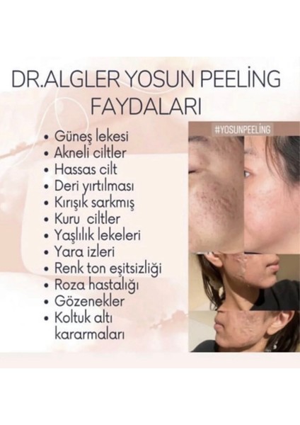 Yosun Peeling 30 Kullanım