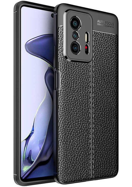 - Xiaomi Mi 11T Pro 5g - Kılıf Deri Görünümlü Auto Focus Karbon Niss Silikon Kapak