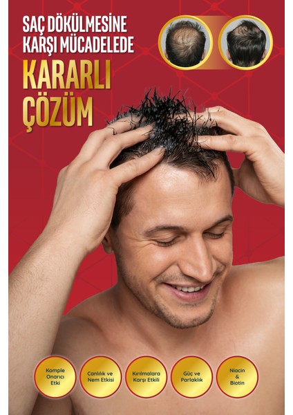 Storm Derma Stımulating Shampoo Niacın - Biotın Dökülme Karşıtı 400 ml