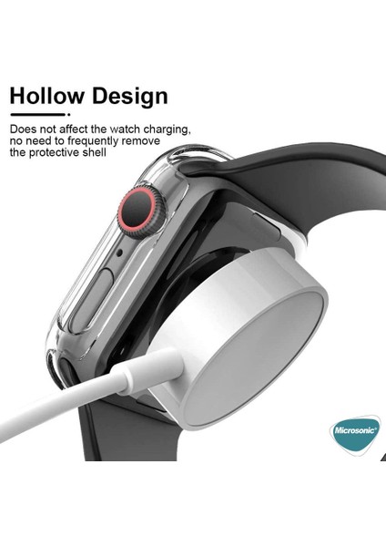 Apple Watch Series 10 42MM Kılıf Clear Premium Slim Watchband Şeffaf