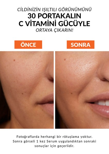 Anew Vitamin C Canlandırıcı Serum 30 ml. Üçlü Set