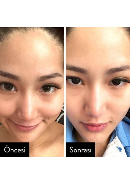 Rice Toner Arındırıcı Aydınlatıcı Pirinçli Tonik 150 ml fırsatları