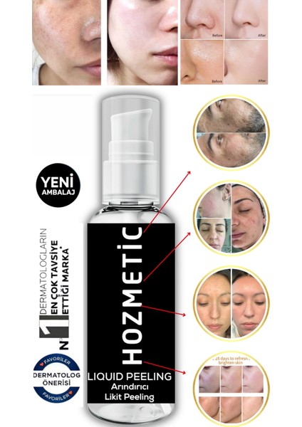 Anında Soyucu Krem Peeling Ölü Deri Arındırıcı Yenileyici Gözenek Aydınlatıcı Vücut Yüz Peelingi Jel