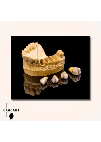Tekli Yatay Kanvas Dişçi Duvar Tablosu Hd Dental Diş Görseli modelleri