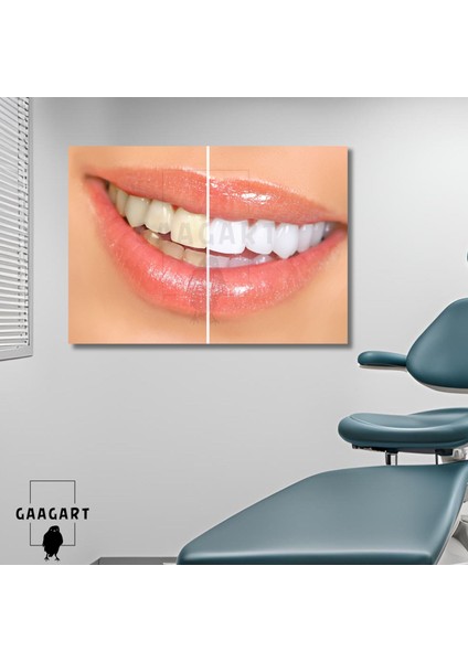 Tekli Yatay Kanvas Diş Sağlığı Poliklinik Tablo Dekoratif Diş