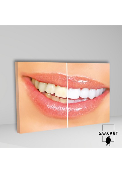 Tekli Yatay Kanvas Diş Sağlığı Poliklinik Tablo Dekoratif Diş fiyatları