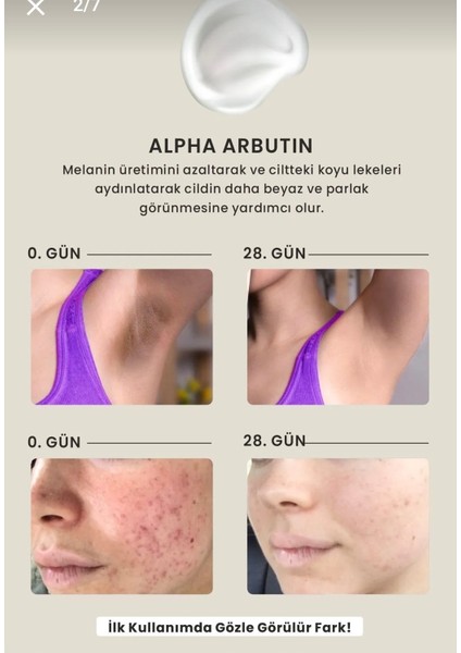 Cilt Beyazlatıcı Aydınlatıcı Glutatyonlu Leke Karşıtı Krem Genital Bölge Koltuk Altı Dirsek 50ML