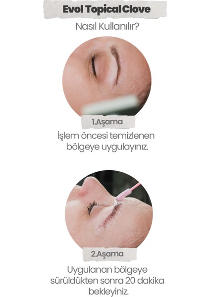 Topical Clove Topikal Krem Epilasyon Dövme Prp 5 x 10 ml