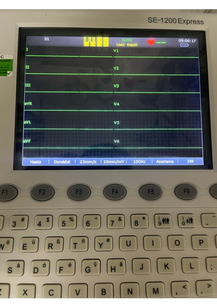 Ekg Cihazı