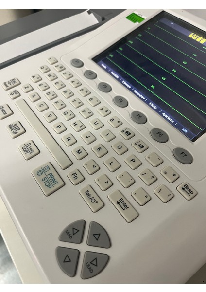 Ekg Cihazı