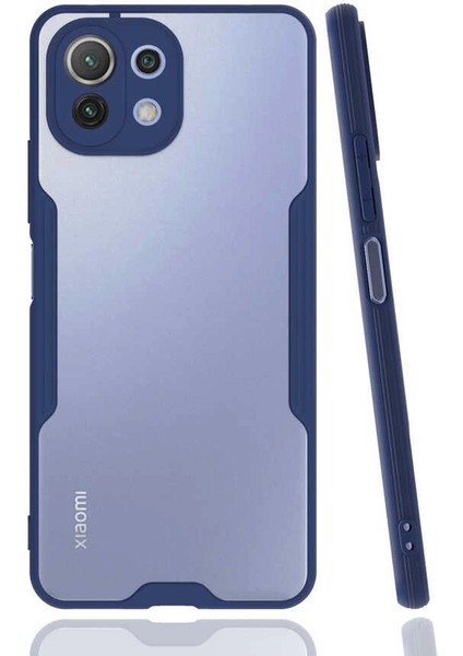 Xiaomi Mi 11 Lite Uyumlu Kılıf Parfe Kapak