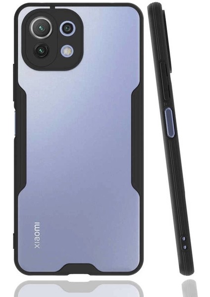 Xiaomi Mi 11 Lite Uyumlu Kılıf Parfe Kapak