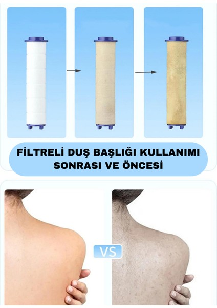 Filtreli Arıtmalı Masajlı Çok Fonksiyonlu Siyah Elit Duş Başlığı + 3 Adet Filtre fiyatları