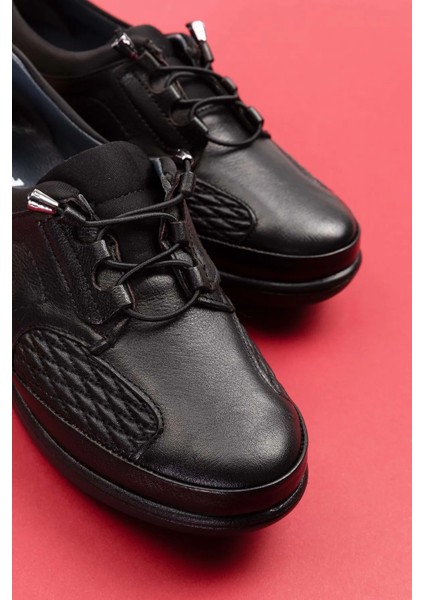 Ortopedik Kadın Deri Ayakkabı Topuk Diken Kemik Çıkıntısı ve Taraklı Ayaklar Için Üretilmiştir fırsatları