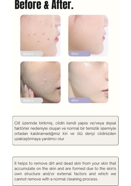 Soyucu Peeling Jel Krem 2 Adet
