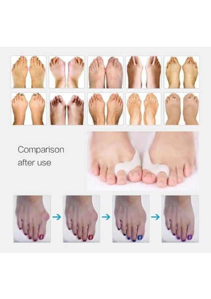 Orta Parmağa Uygun Metatarsal Destek Pedi, Rahat ve Hafifayırıcı Dizlik fiyatları