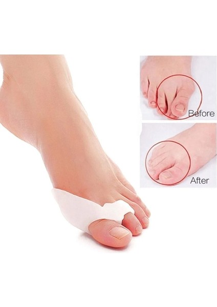 Orta Parmağa Uygun Metatarsal Destek Pedi, Rahat ve Hafifayırıcı Dizlik indirimleri