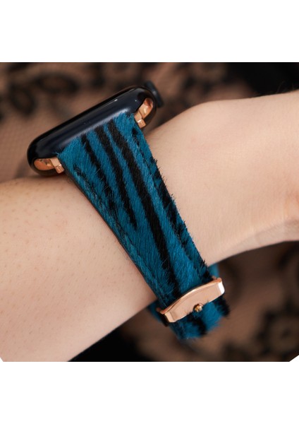 Apple Watch 10 46mm Uyumlu Kadın Deri Kordon 10. Nesil 46mm Mavi Zebra Desenli Deri Kordon Kadınlara Özel Apple Watch Kordonu Anneler Günü Sevgililer Günü Hediyesi Vadiva