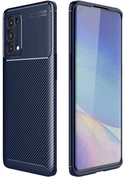 Oppo Reno 5 Pro 5g Kılıf Negro Karbon Desen Silikon