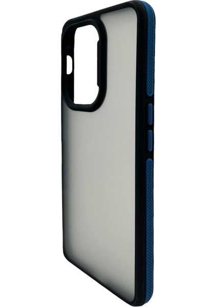 Oneplus Nord Ce3 5g Uyumlu NT-N049 Arka Koruma Kılıf