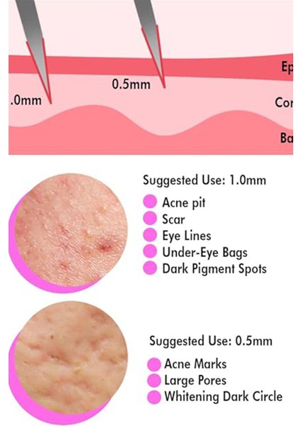 Dermoroller Full Çelik 540 Iğne Derma Roller 1.0 mm