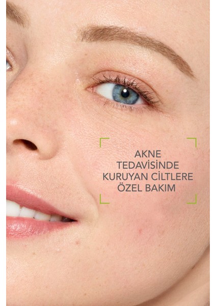 Hydra Intensive Ceramide Containing Drying Acne Treatment Soothing Care Cream 40 ml GKÜRN936 fiyatları