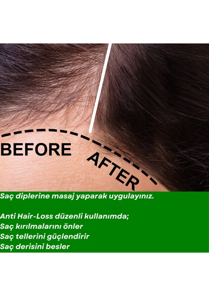 ANTI HAIR LOSS- 10 FORCES Saç Dökülmelerine Karşı 10 Aromatik Yağ Karışımı fırsatları