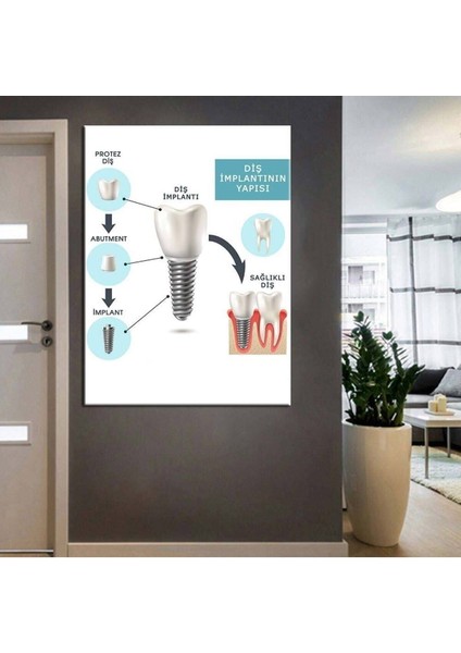 Ağız ve Diş Sağlığı Polikliniği Tabloları Dekoratif Diş, Dekoratif Dişçi, Dişçi Dekorasyonu Dsc-58