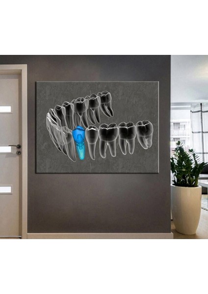 Ağız ve Diş Sağlığı Polikliniği Tabloları Dekoratif Diş, Dekoratif Dişçi, Dişçi Dekorasyonu DSC-160