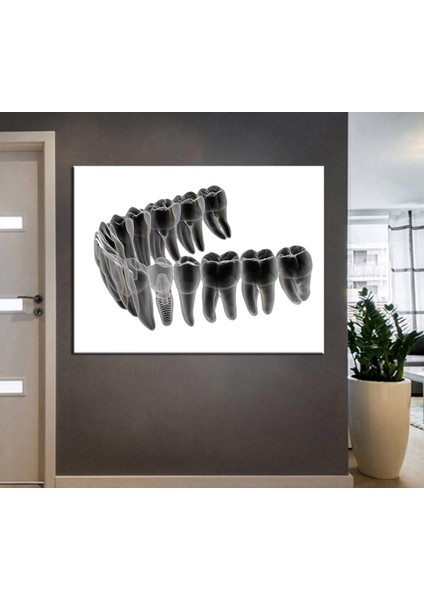 Ağız ve Diş Sağlığı Polikliniği Tabloları Dekoratif Diş, Dekoratif Dişçi, Dişçi Dekorasyonu DSC-159