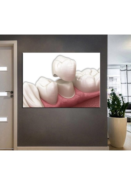 Ağız ve Diş Sağlığı Polikliniği Tabloları Dekoratif Diş, Dekoratif Dişçi, Dişçi Dekorasyonu DSC-162