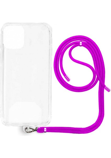 Xiaomi Mi 14 Pro İp Askılı Şeffaf Silikon Kılıf Koyu Pembe