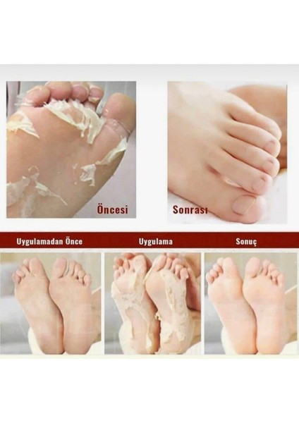 4adet Marlett Foot Peeling Pack,Professional Çorap Tipi Ayak Maskesi,Soyulabilen Ayak Maskesi