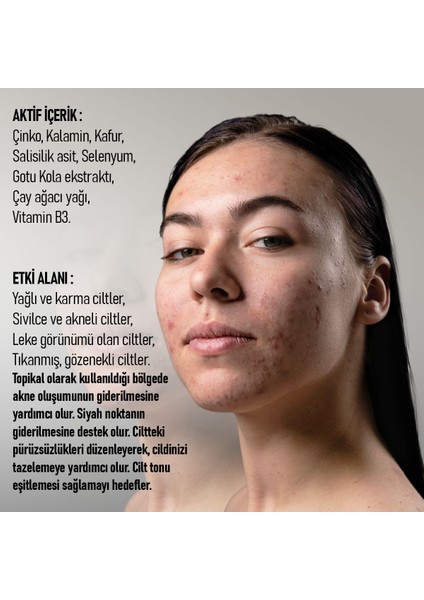 Exigency Anında Etkili Akne Bakım Solüsyonu – 30ML. modelleri