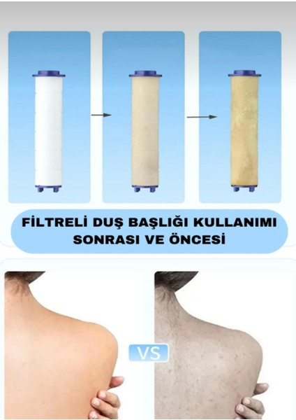 (Kireç Önleyici) 5 Fonksiyonlu Su Tasarruflu Filtreli Turbo Jet Duş Başlığı Siyah