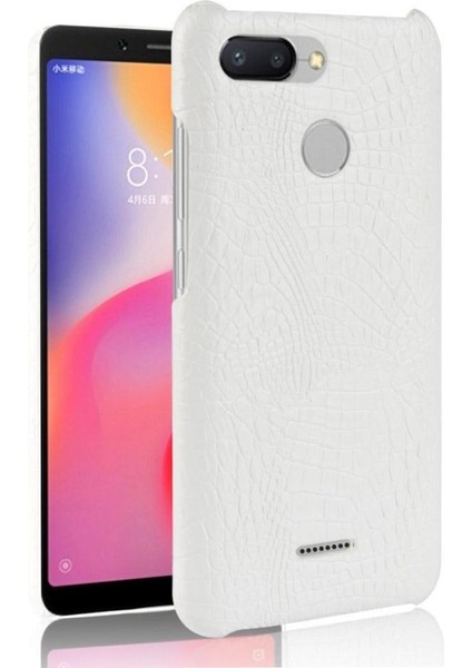 Xiaomi Redmi 6 Anti Scratch Koruyucu Kapak Için Şık Klasik Durumda (Yurt Dışından)