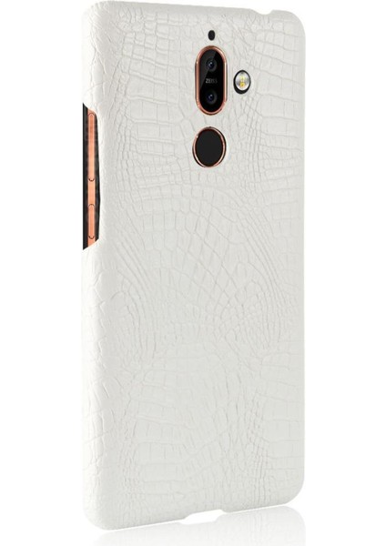 Nokia 7 Plus Anti Scratch Klasik Timsah Kapağı Için Şık Klasik Kılıf (Yurt Dışından) modelleri