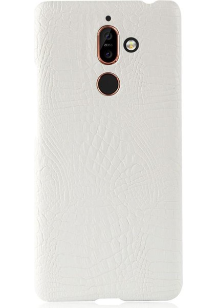 Nokia 7 Plus Anti Scratch Klasik Timsah Kapağı Için Şık Klasik Kılıf (Yurt Dışından) fırsatları