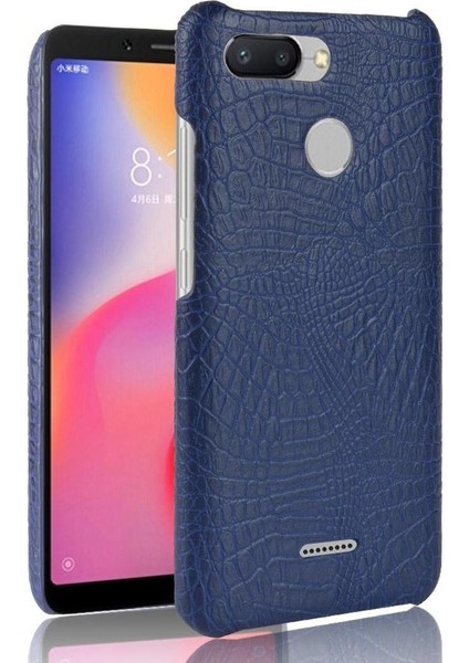 Xiaomi Redmi 6 Anti Scratch Koruyucu Kapak Için Şık Klasik Durumda (Yurt Dışından)