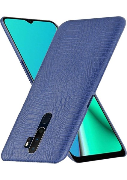Oppo A9 2020/OPPO A5 2020/OPPO A11 Klasik Kapak Için Şık Klasik Kılıf (Yurt Dışından)