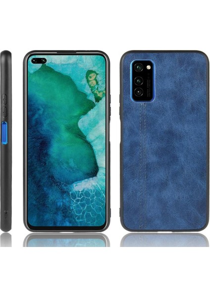 Onur V30 Pro Klasik Darbeye Dayanıklı Hafif Tasarım (Yurt Dışından)