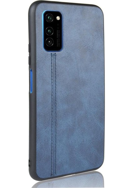 Onur V30 Pro Klasik Darbeye Dayanıklı Hafif Tasarım (Yurt Dışından)
