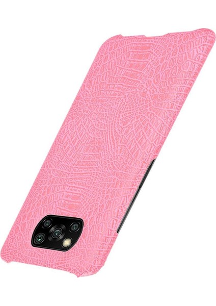 Şık Klasik Durumda Xiaomi Poco X3 Nfc Klasik Timsah Moda Anti (Yurt Dışından)