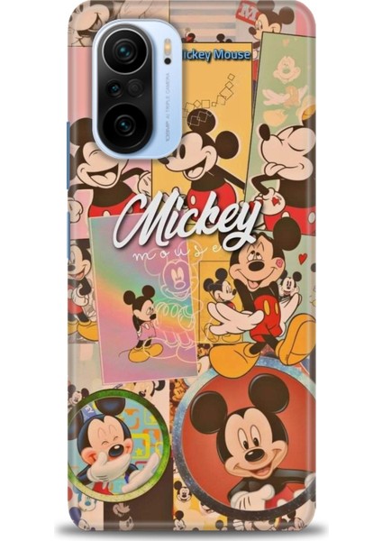 Xiaomi Mi 11I Kılıf Hd Baskılı Kılıf - I Love Mickey + 9h Nano Ekran Koruyucu