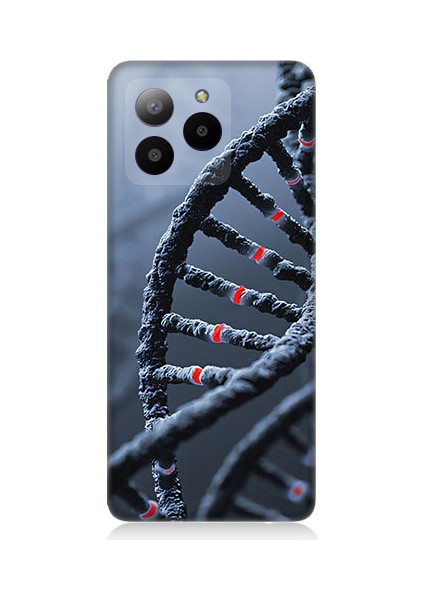 Omix X7 Uyumlu Dna Sarmalı Desenli Silikon Kılıf