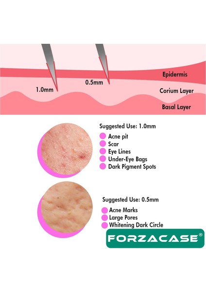 Dermaroller 0.5 mm 540 İğneli Masaj Aleti - Saç Skin Cilt Tarağı